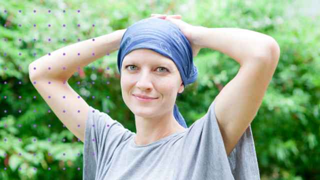 La pérdida de las cejas y del pelo es uno de los efectos secundarios de la quimioterapia.