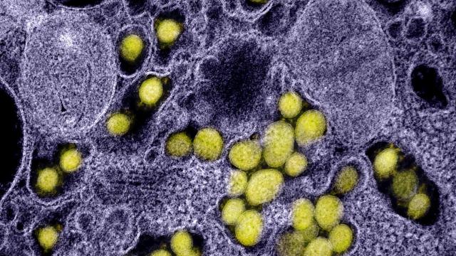 Micrografía electrónica de transmisión de partículas del virus SARS-CoV-2.