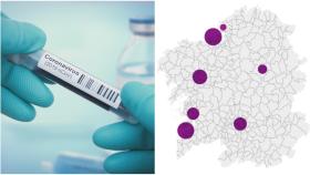 Coronavirus: 151 nuevos contagios en Galicia y 8848 totales en vísperas de la desescalada