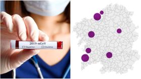 Coronavirus: 37 nuevos contagios en Galicia y 9.134 casos positivos en total
