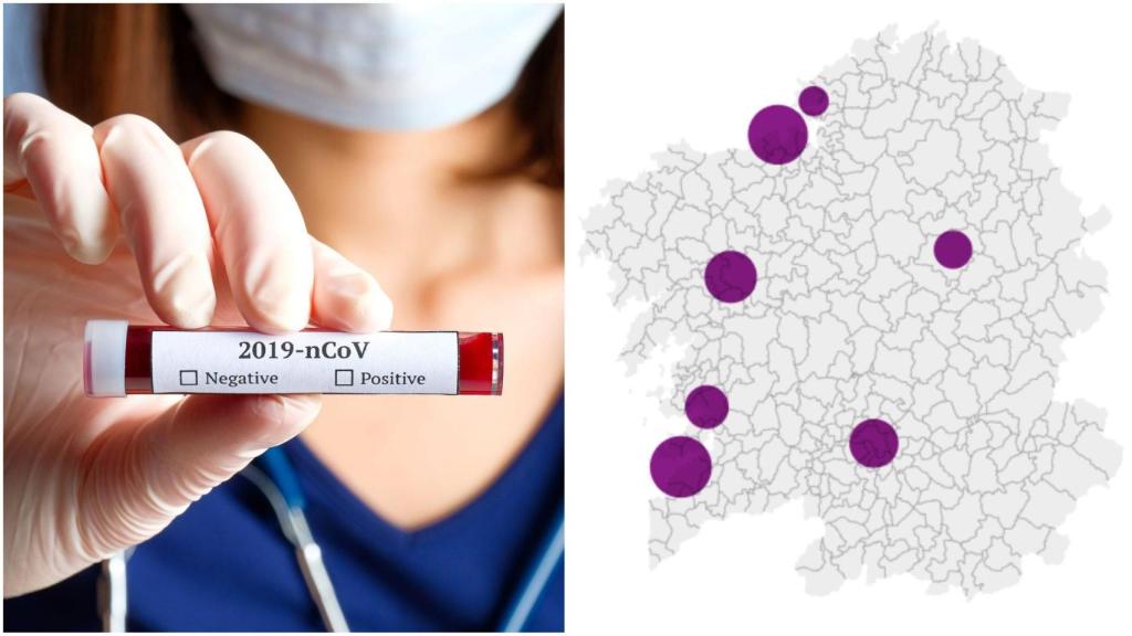 Coronavirus: Solo 6 nuevos contagios en Galicia y 9.323 casos positivos en total