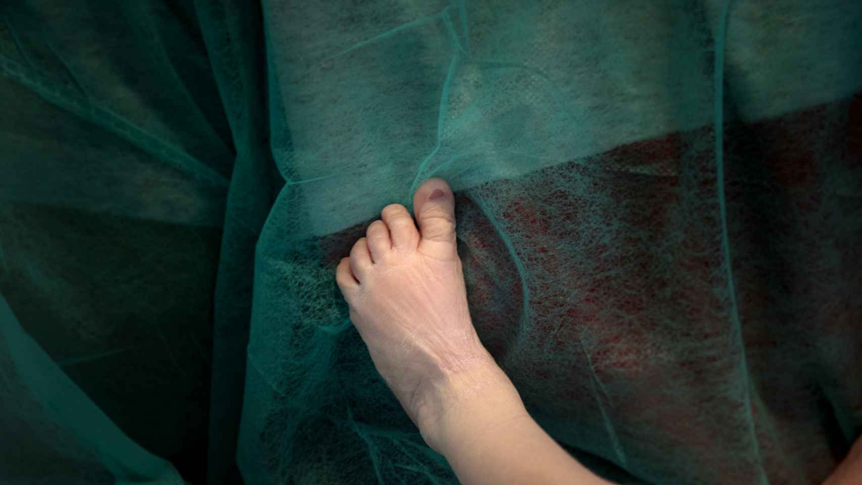 El pie de Aritz en el hospital, en brazos de su padre.
