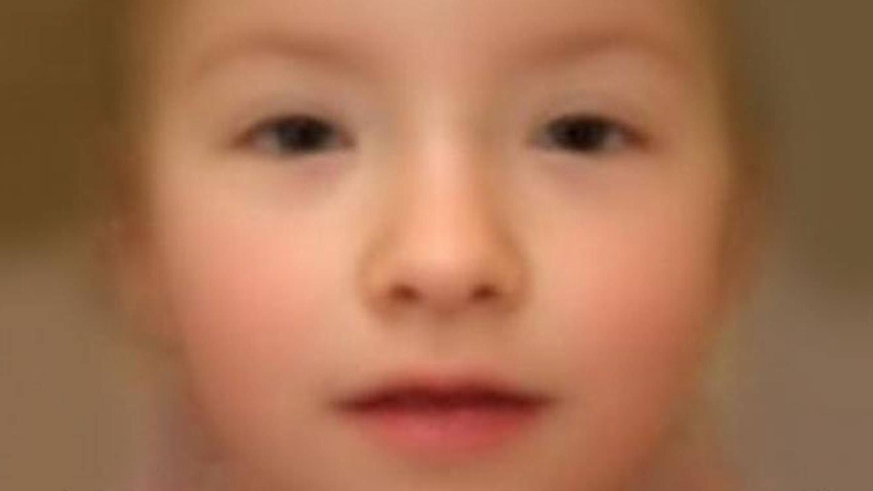 Rostro de un niño con síndrome TRAF7 generado por ordenador para ayudar a reconocer la enfermedad (Genetics in Medicine).