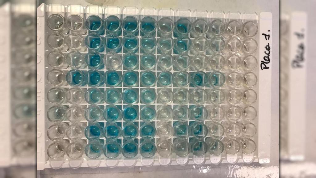 Los resultados de nuestro test. Los huecos transparentes son los negativos.