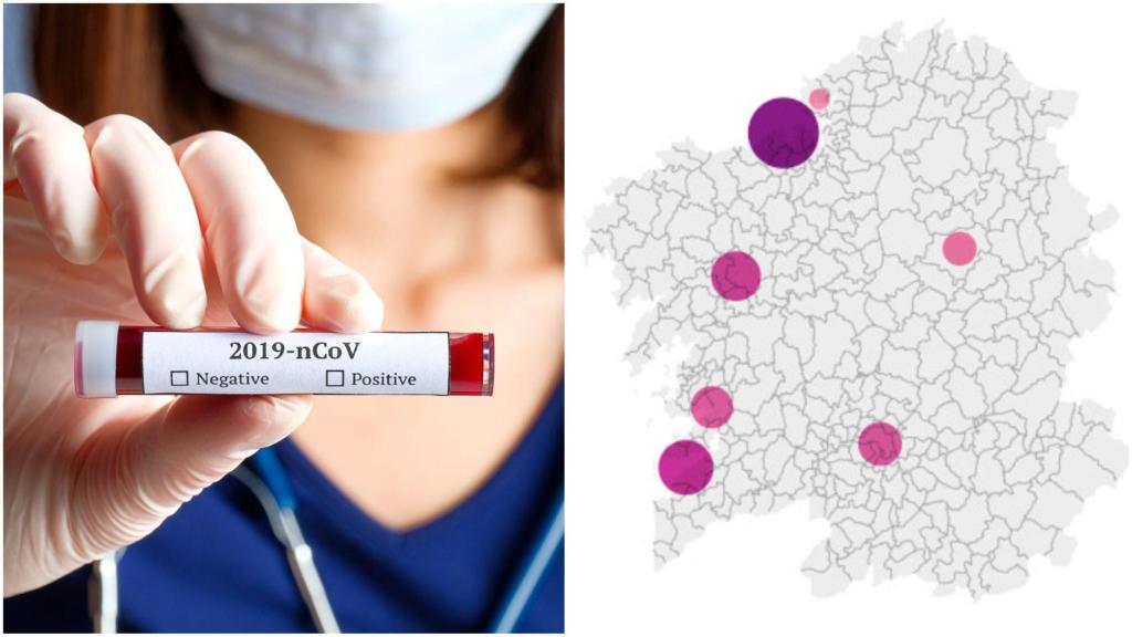 Coronavirus: 18 nuevos positivos en Galicia en todos los tests y 869 casos activos