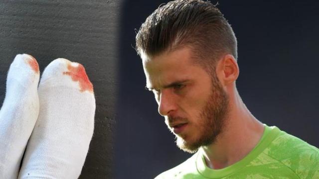 David de Gea y sus pies ensangrentados