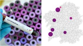 Coronavirus: Solo 4 nuevos positivos en Galicia en todos los tests y 834 casos activos