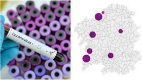 Coronavirus: 3 nuevos positivos PCR en Galicia y 9.115 casos totales