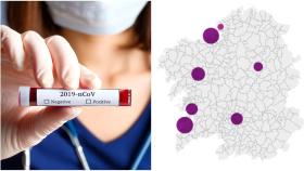 Coronavirus: Solo 1 positivo en Galicia en todos los tests y 515 casos activos