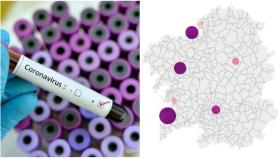 Coronavirus: 18 positivos en Galicia, 3 en A Coruña, y bajan a 279 los casos activos