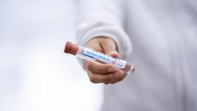coronavirus prueba test rebrote