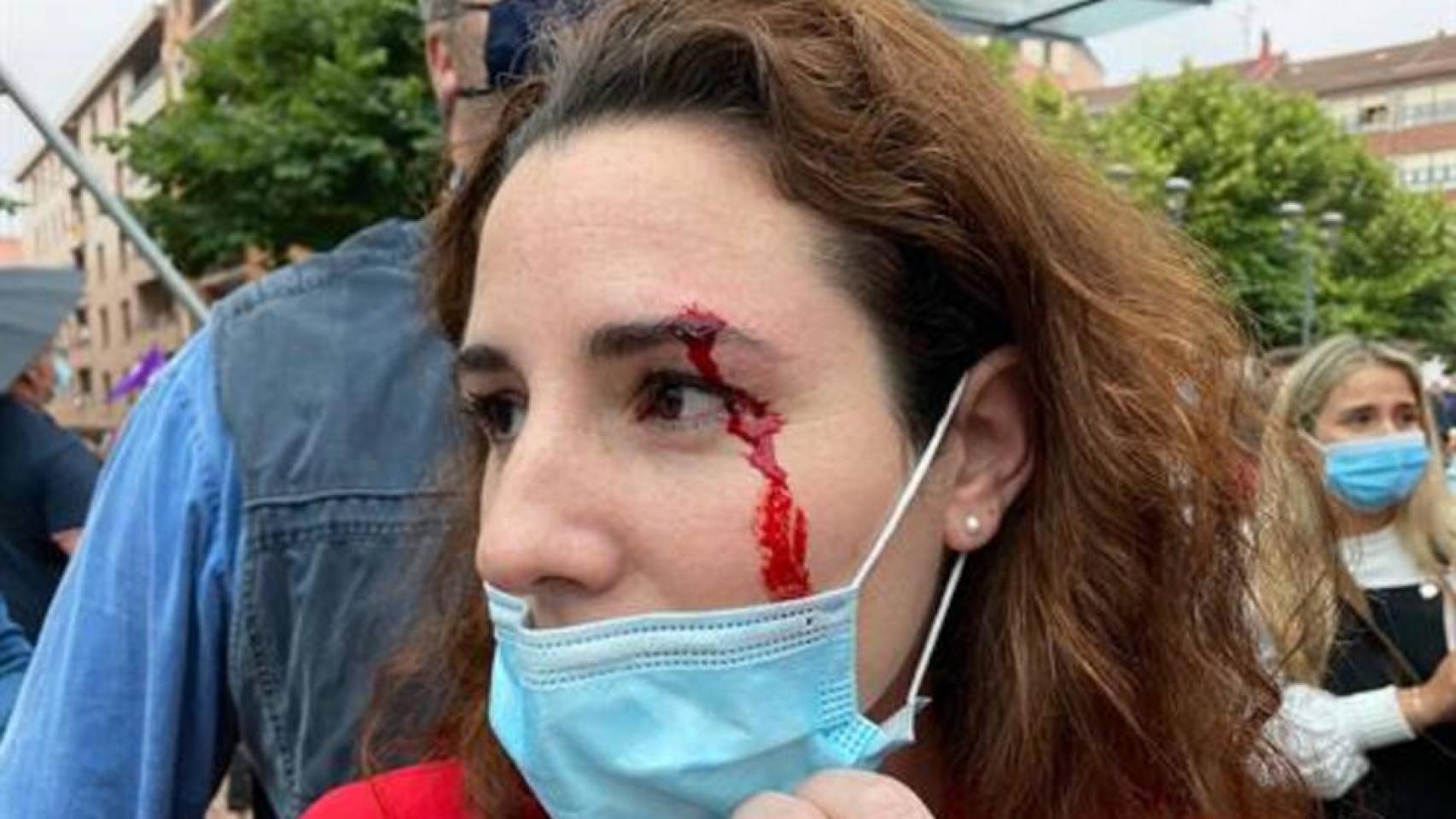 La diputada Rocío de Meer con sangre en la cara tras recibir la pedrada