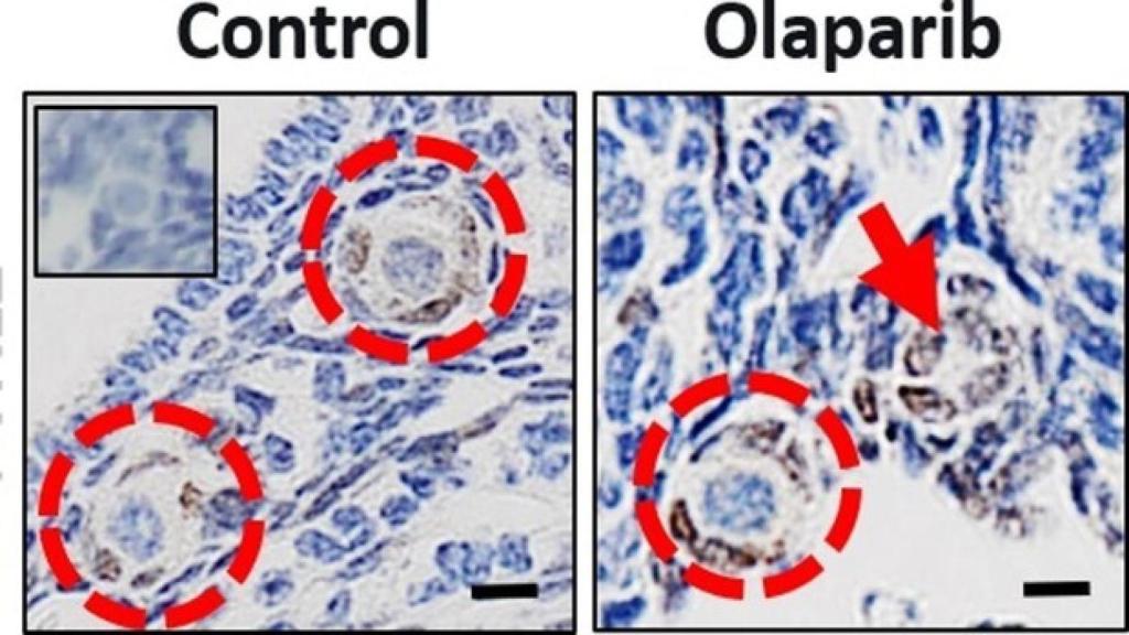 La imagen de la izquierda muestra dos folículos primordiales sanos que contienen óvulos en un ovario normal. La de la derecha refleja el resultado después de olaparib, donde los restos de folículos primarios carecen de óvulos.