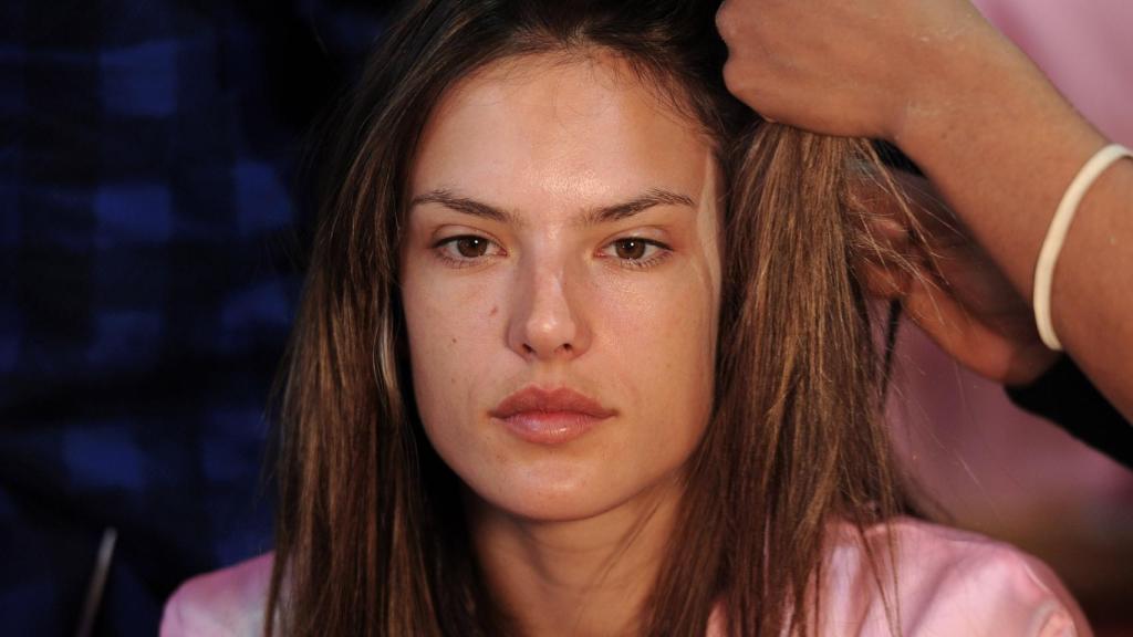 La descamación suele estar acompaña de una irritación y picor del cuero cabelludo.