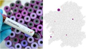 Coronavirus: 191 positivos nuevos en Galicia, 50 en A Coruña y 2.580 casos activos