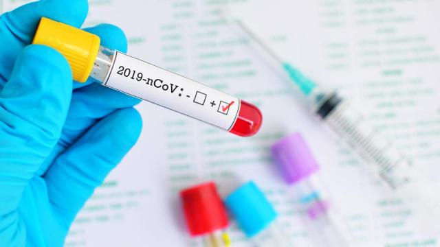 CC.OO denuncia la falta de protocolos tras varios positivos en recintos de la Xunta