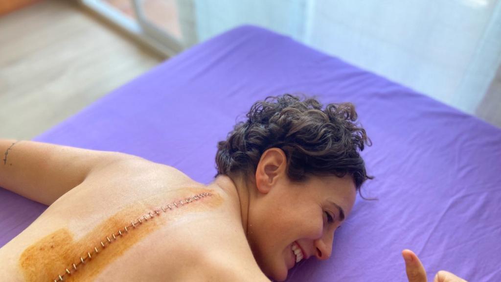 Ana Carrasco enseña su herida en la espalda