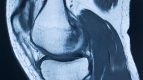 Imagen médica de una articulación de rodilla.
