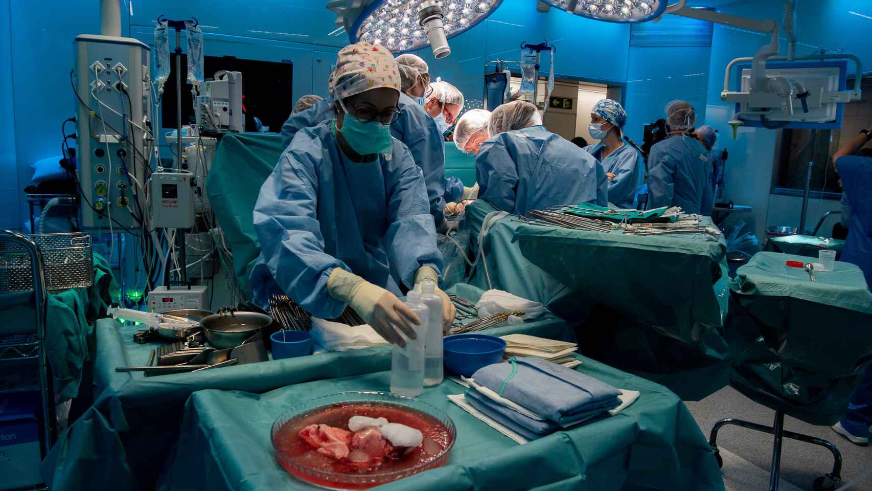Un equipo médico realiza un trasplante.