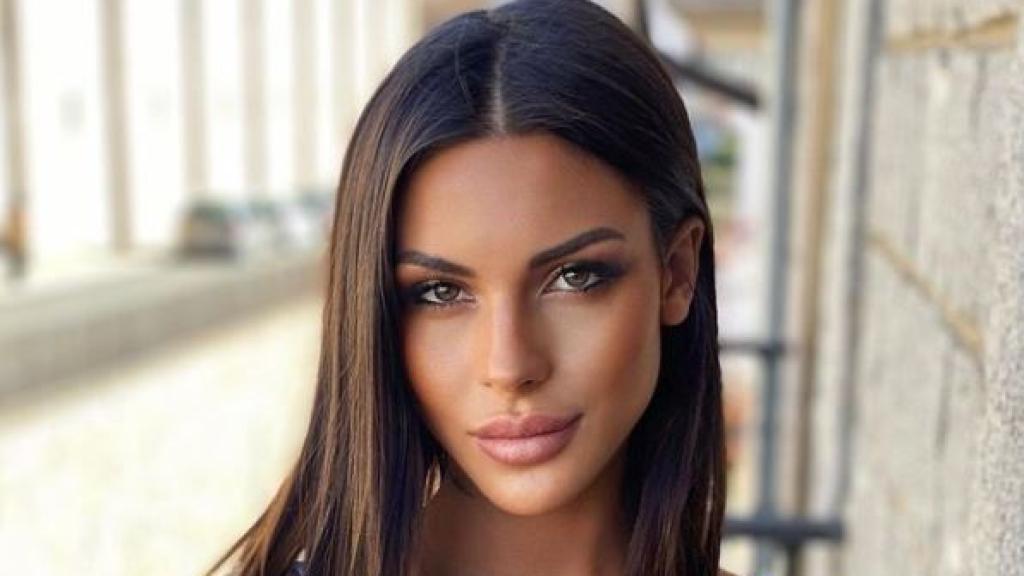 Alba está feliz con sus cambios estético y de hecho retoca sus labios cada poco tiempo.