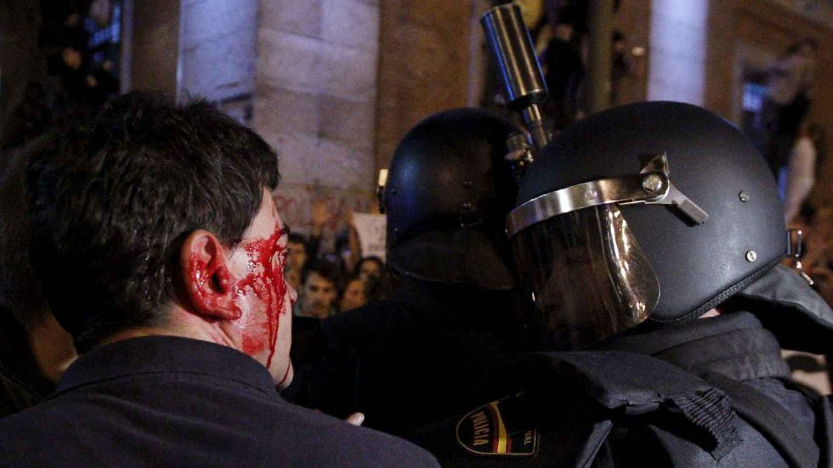 Un hombre herido durante la manifestación del 25 de septiembre de 2012.