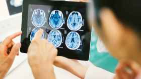 Un equipo médico examina radiografías de encéfalo.