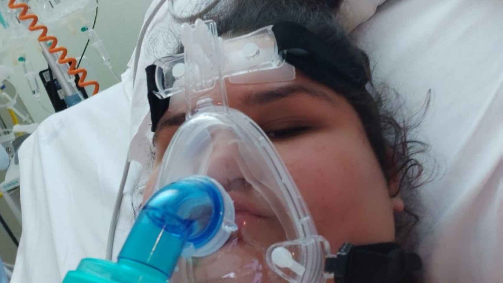 María Sherezade necesitó la ayuda de la ventilación mecánica para poder respirar.