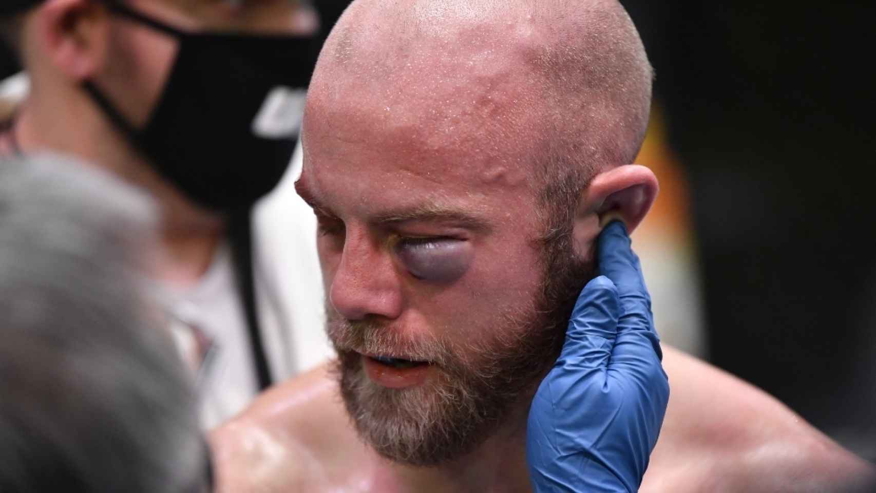 La cara de Justin Jaynes tras su pelea con Devonte Smith. Foto: Twitter (@UFC)