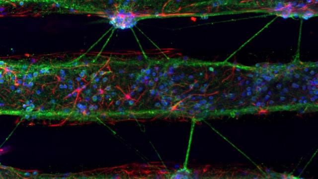 Cultivos neuronales marcados con anticuerpos fluorescentes.