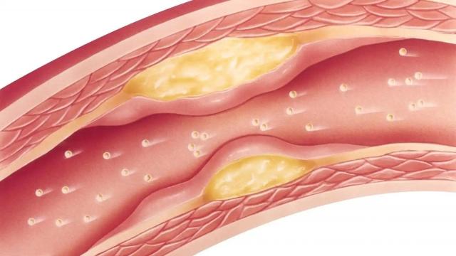 Colesterol