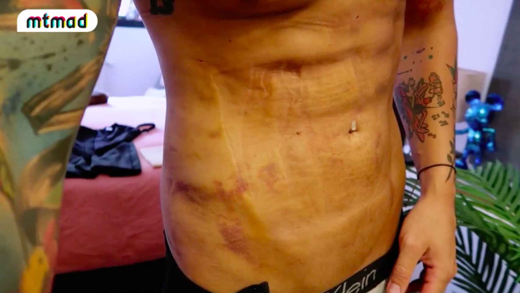 Así mostró Diego Matamoros su abdomen tras someterse a una lipo este verano.