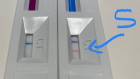 Resultados de dos test rápidos de anticuerpos con la misma muestra.