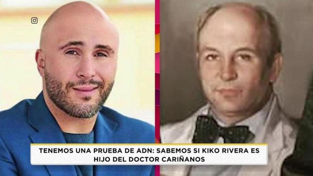 Kiko Rivera en una comparativa junto al doctor Cariñanos en el programa 'Socialité'.