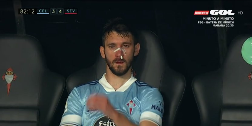 Facundo Ferreyra tras recibir un brutal codazo de Fernando