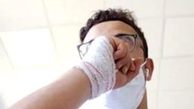 Khalid muestra el vendaje en su mano derecha a causa de una supuesta agresión.