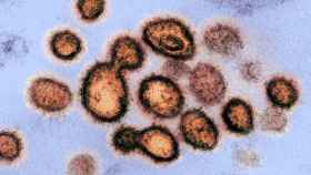El coronavirus visto a través del microscopio.