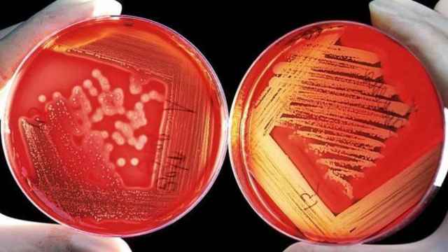 Dos cultivos de laboratorio con bacterias.