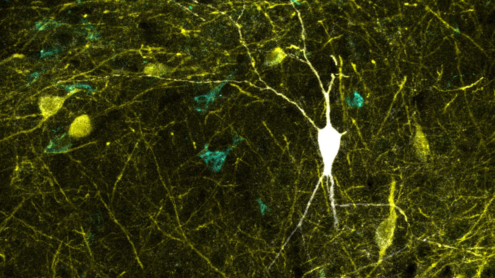 Neurona inhibidora del hipocampo registrada y teñida in vivo (en blanco).