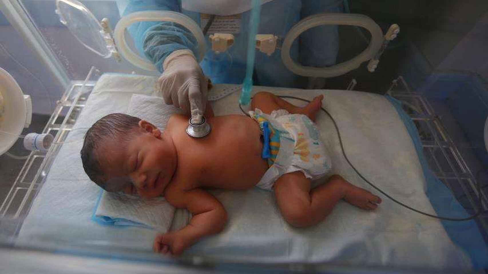 El virus respiratorio sincitial suele ser causa de graves infecciones en neonatos.