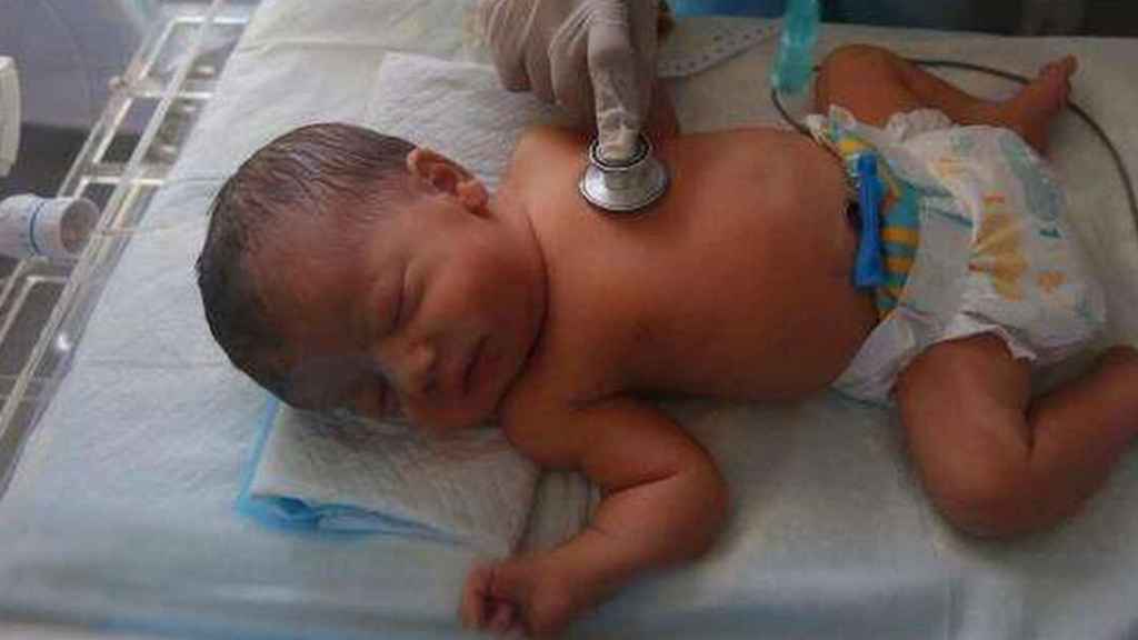 Un neonato ingresado en un hospital a causa del VRS.