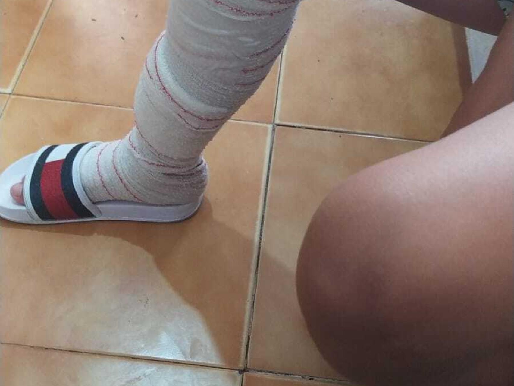 El pequeño José luce un aparatoso vendaje.