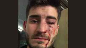 Un chico gay muestra su foto tras una agresión homófoba en el metro de Barcelona