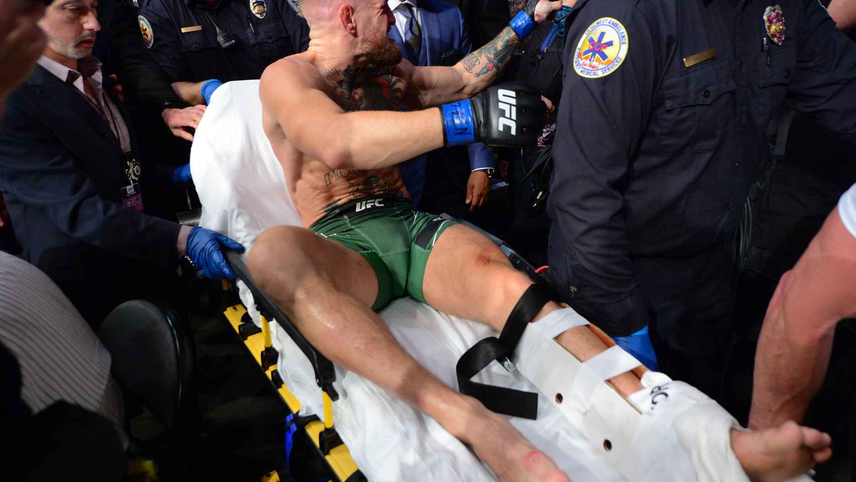 McGregor, retirado en camilla por una fractura de tibia
