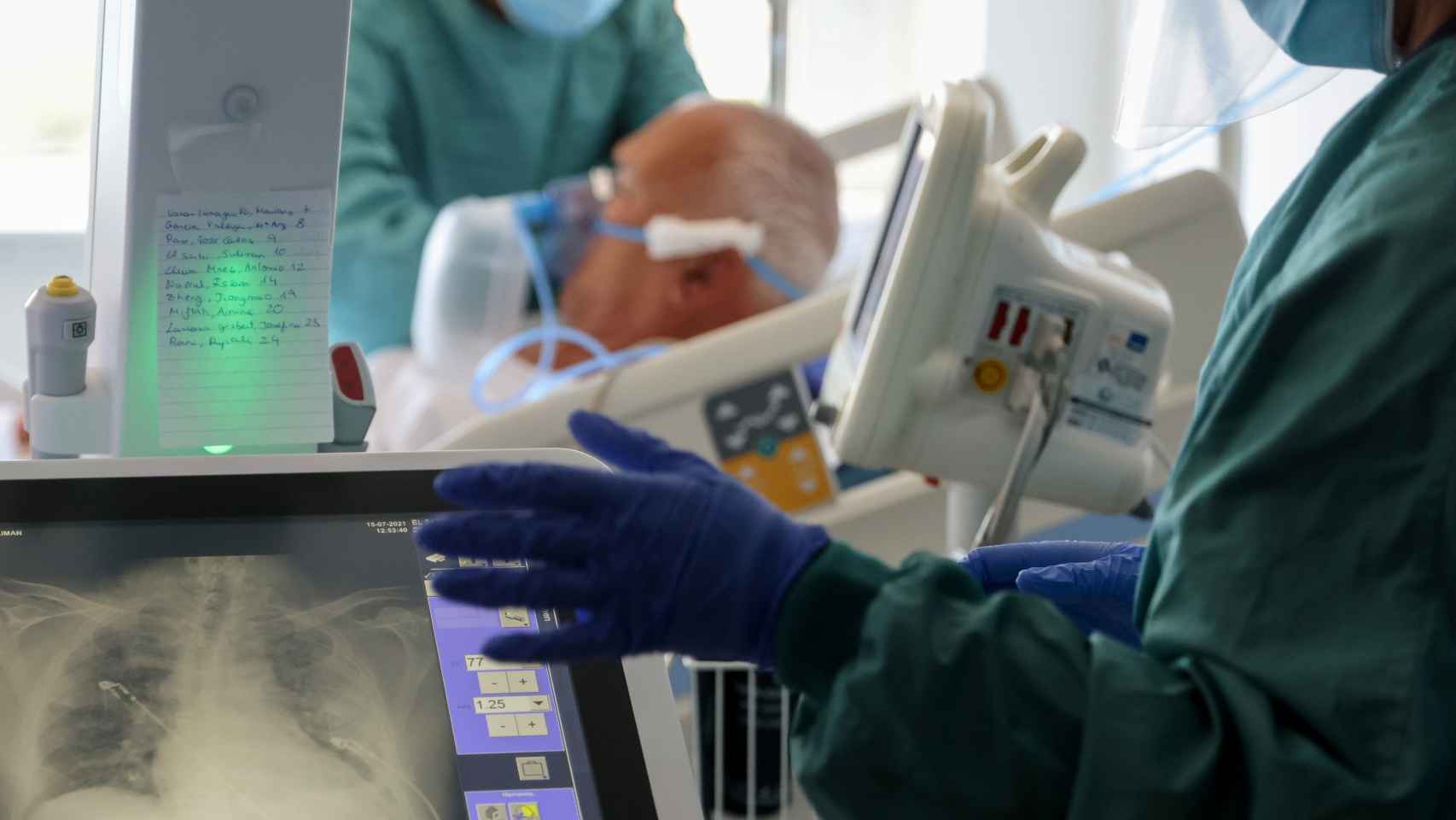 Imagen de los pulmones de un paciente enfermo de Covid en el Hospital del Mar, en Barcelona.