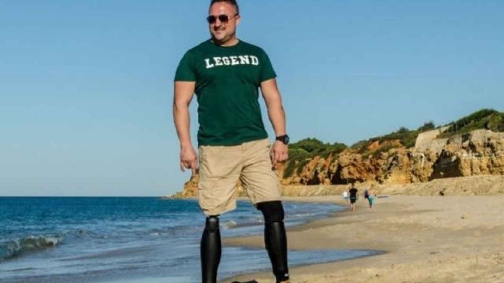 Francisco José usa dos prótesis para caminar después de perder ambas piernas en un accidente en 2002.