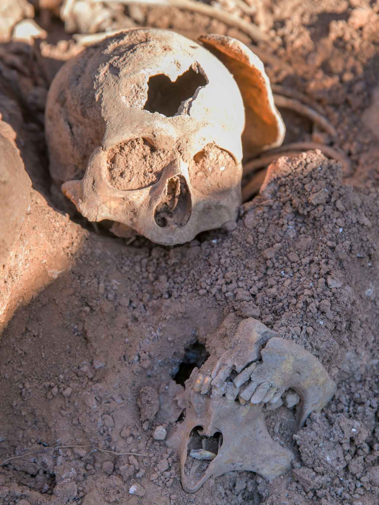 Cráneo atravesado por una bala.
