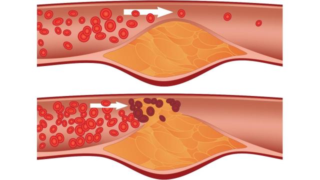 Niveles de colesterol en la sangre. Europa Press.