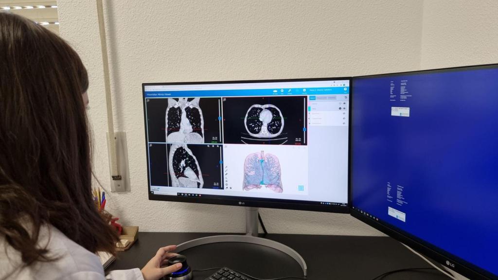 El CHUAC amplía el centro tecnológico de formación con impresión 3D y simulación clínica