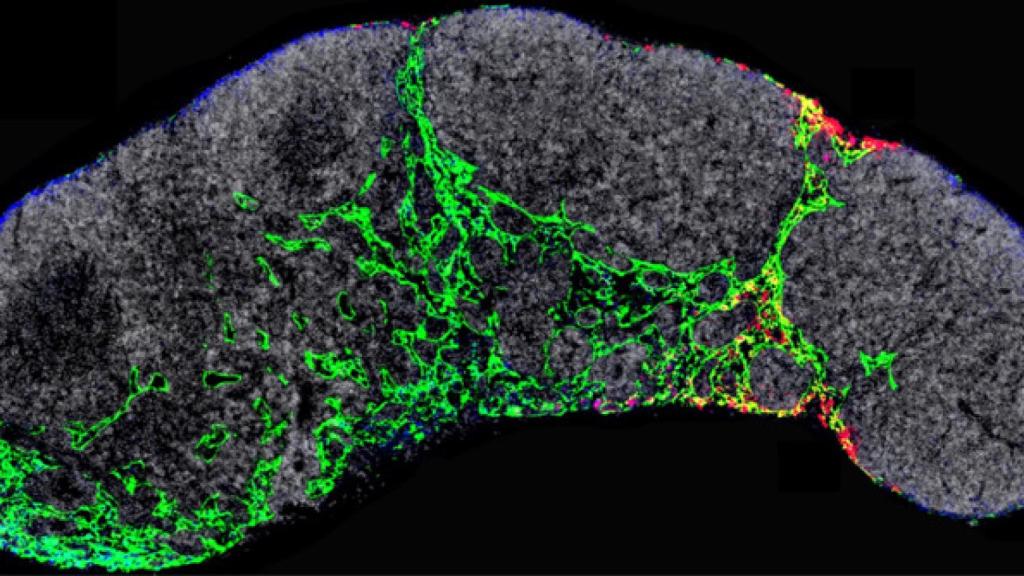 Nodulo linfático de un ratón con los conductos linfáticos (verde) y los exosomas tumorales (Rojo)