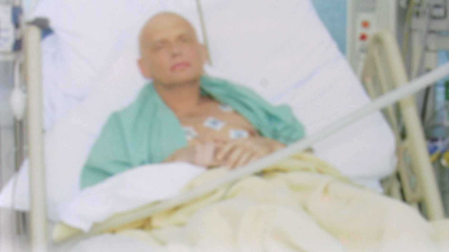 Litvinenko en la cama del hospital tras ser envenenado.
